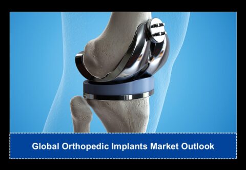 Global Orthopedic Implants Market Outlook