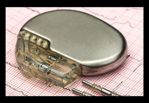 Pacemakers Market Outlook