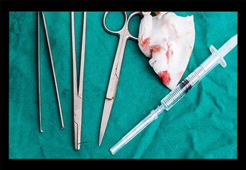 Global Wound Care Devices Market Outlook