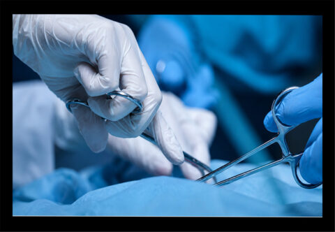Global Ambulatory Surgery Centers Market Outlook